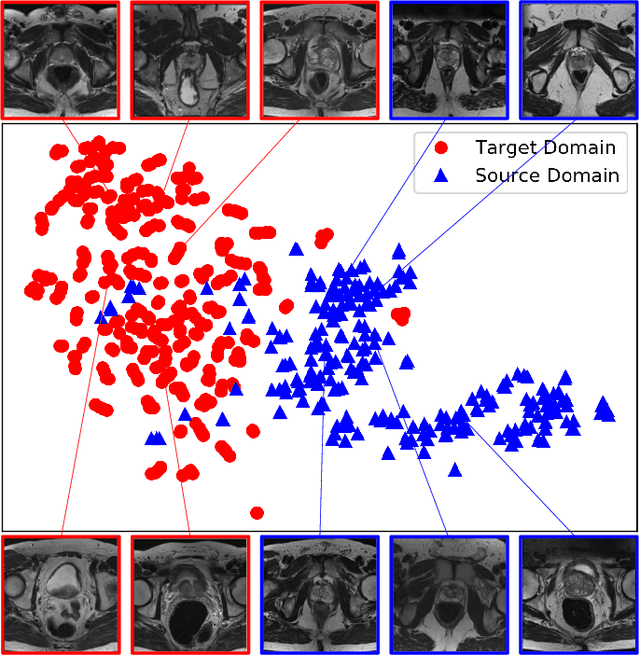 Figure 1 for Boundary-weighted Domain Adaptive Neural Network for Prostate MR Image Segmentation