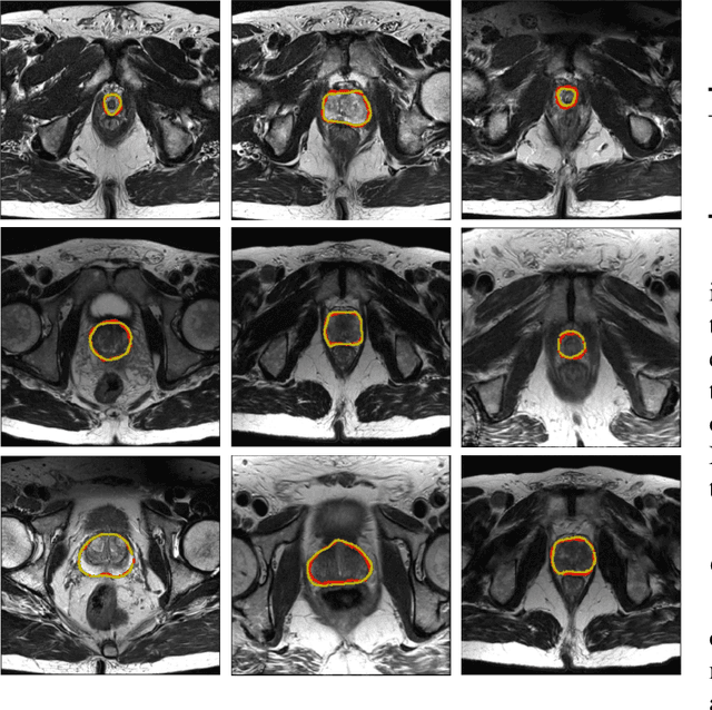 Figure 4 for Boundary-weighted Domain Adaptive Neural Network for Prostate MR Image Segmentation