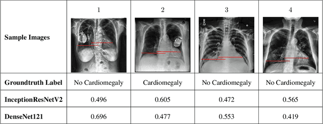 Figure 4 for Generalization of Deep Convolutional Neural Networks -- A Case-study on Open-source Chest Radiographs
