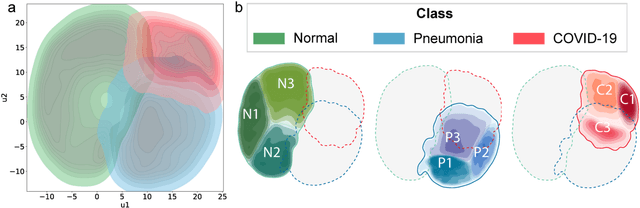 Figure 3 for CIRCA: comprehensible online system in support of chest X-rays-based COVID-19 diagnosis