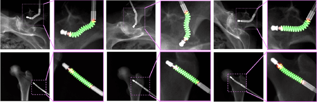 Figure 2 for Localizing dexterous surgical tools in X-ray for image-based navigation