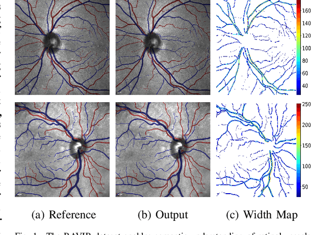 Figure 1 for RAVIR: A Dataset and Methodology for the Semantic Segmentation and Quantitative Analysis of Retinal Arteries and Veins in Infrared Reflectance Imaging