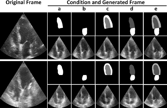 Figure 1 for GAN-enhanced Conditional Echocardiogram Generation