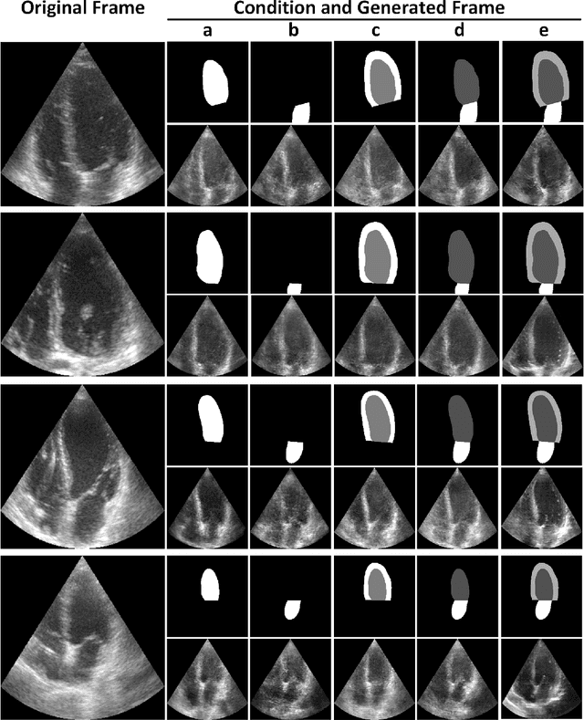Figure 2 for GAN-enhanced Conditional Echocardiogram Generation