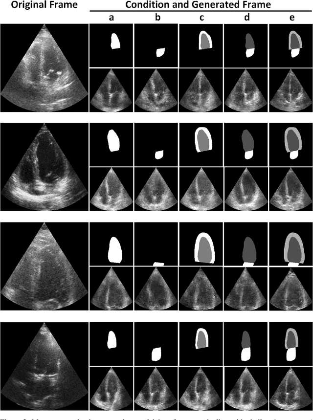 Figure 3 for GAN-enhanced Conditional Echocardiogram Generation