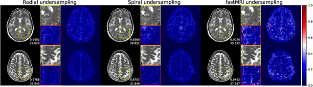 Figure 3 for Towards Ultrafast MRI via Extreme k-Space Undersampling and Superresolution