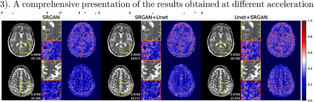 Figure 4 for Towards Ultrafast MRI via Extreme k-Space Undersampling and Superresolution