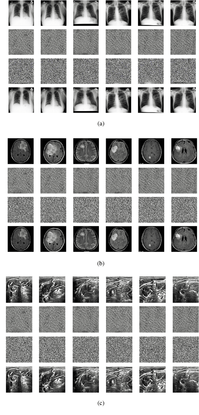 Figure 4 for DeepKeyGen: A Deep Learning-based Stream Cipher Generator for Medical Image Encryption and Decryption