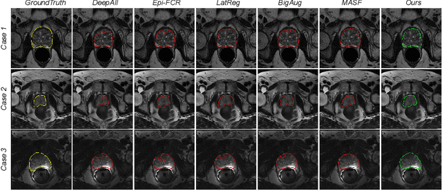 Figure 3 for Shape-aware Meta-learning for Generalizing Prostate MRI Segmentation to Unseen Domains