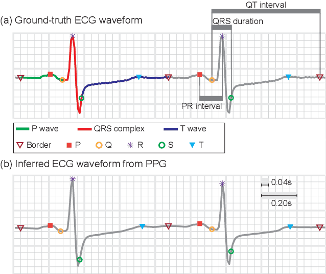 Figure 3 for Cross-domain Joint Dictionary Learning for ECG Inference from PPG