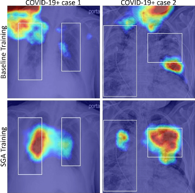 Figure 1 for Saliency Guided Adversarial Training for Learning Generalizable Features with Applications to Medical Imaging Classification System