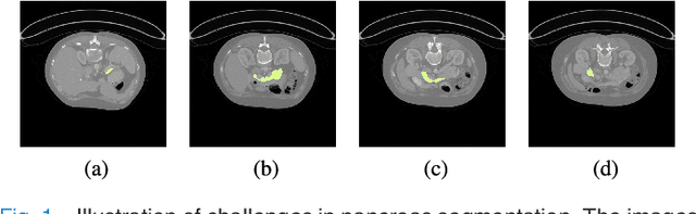 Figure 1 for Deep Q Learning Driven CT Pancreas Segmentation with Geometry-Aware U-Net