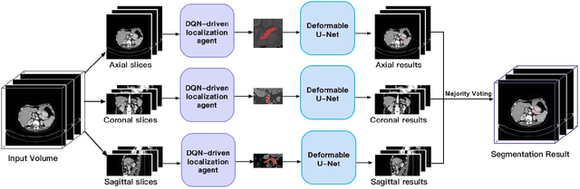 Figure 4 for Deep Q Learning Driven CT Pancreas Segmentation with Geometry-Aware U-Net