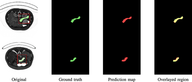 Figure 3 for Deep Q Learning Driven CT Pancreas Segmentation with Geometry-Aware U-Net