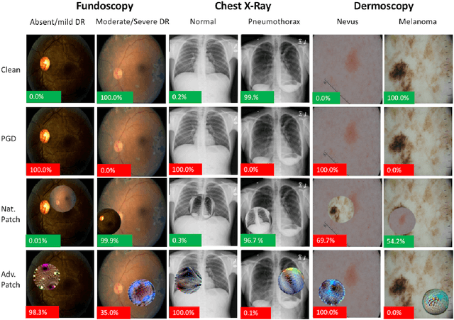 Figure 3 for Adversarial Attacks Against Medical Deep Learning Systems