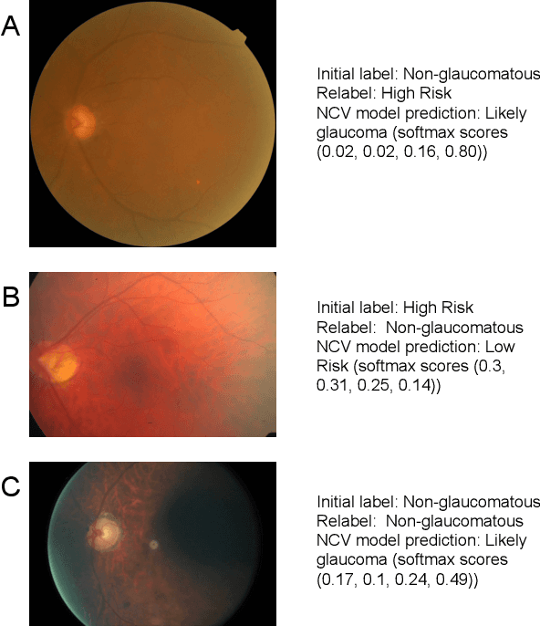 Figure 4 for Improving Medical Annotation Quality to Decrease Labeling Burden Using Stratified Noisy Cross-Validation