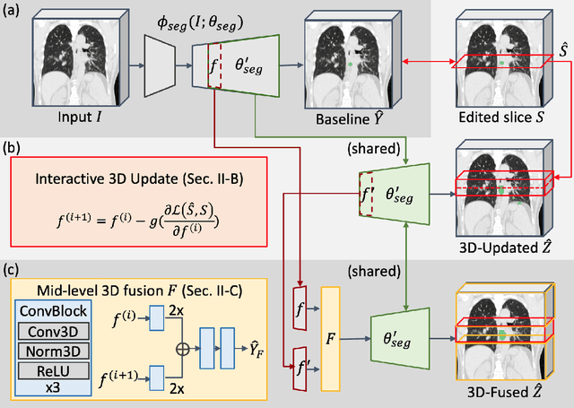 Figure 2 for Interactive Radiotherapy Target Delineation with 3D-Fused Context Propagation