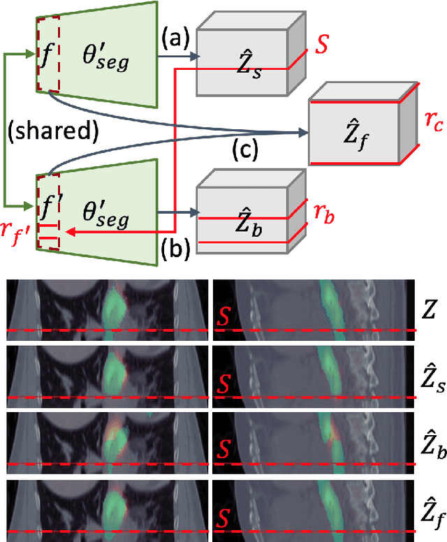 Figure 3 for Interactive Radiotherapy Target Delineation with 3D-Fused Context Propagation