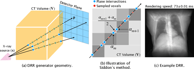 Figure 1 for Fast Auto-Differentiable Digitally Reconstructed Radiographs for Solving Inverse Problems in Intraoperative Imaging