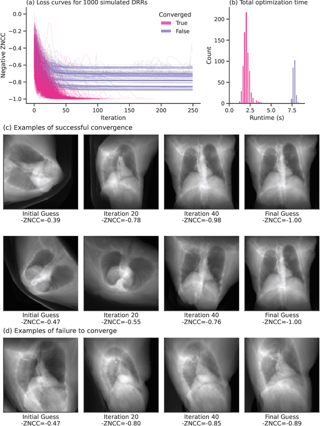 Figure 3 for Fast Auto-Differentiable Digitally Reconstructed Radiographs for Solving Inverse Problems in Intraoperative Imaging