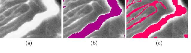 Figure 1 for clDice -- a Topology-Preserving Loss Function for Tubular Structure Segmentation