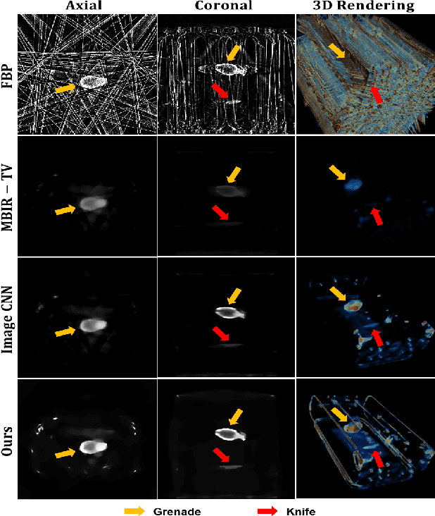 Figure 4 for Deep Learning Reconstruction for 9-View Dual Energy CT Baggage Scanner