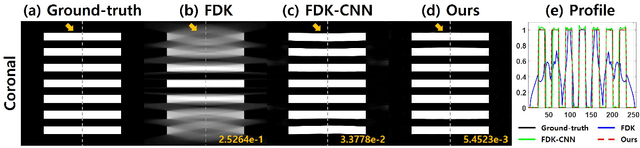 Figure 2 for Differentiated Backprojection Domain Deep Learning for Conebeam Artifact Removal