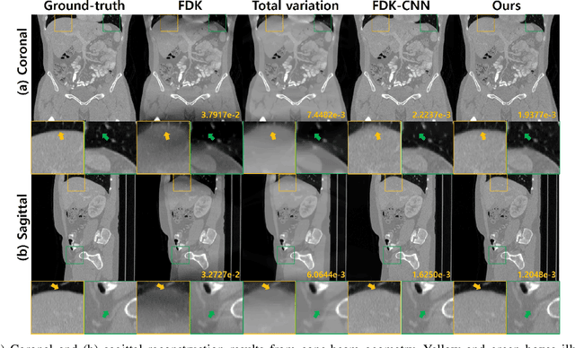 Figure 3 for Differentiated Backprojection Domain Deep Learning for Conebeam Artifact Removal