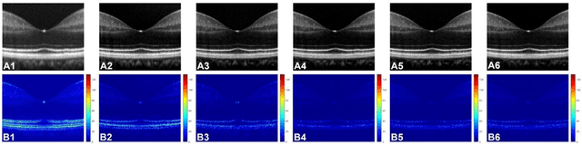 Figure 3 for ADC-Net: An Open-Source Deep Learning Network for Automated Dispersion Compensation in Optical Coherence Tomography