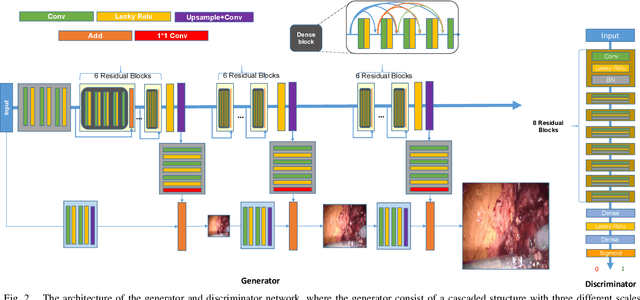 Figure 2 for Real-time Surgical Environment Enhancement for Robot-Assisted Minimally Invasive Surgery Based on Super-Resolution