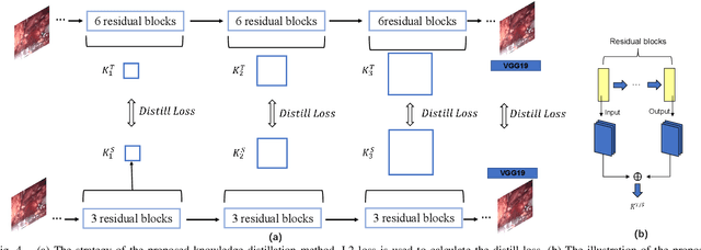 Figure 4 for Real-time Surgical Environment Enhancement for Robot-Assisted Minimally Invasive Surgery Based on Super-Resolution