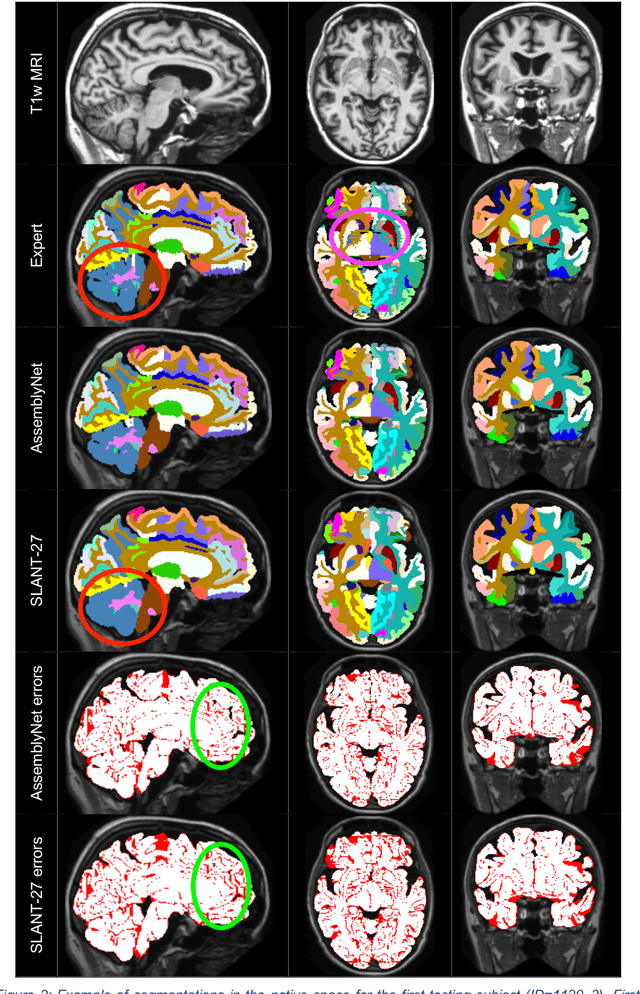 Figure 4 for AssemblyNet: A large ensemble of CNNs for 3D Whole Brain MRI Segmentation