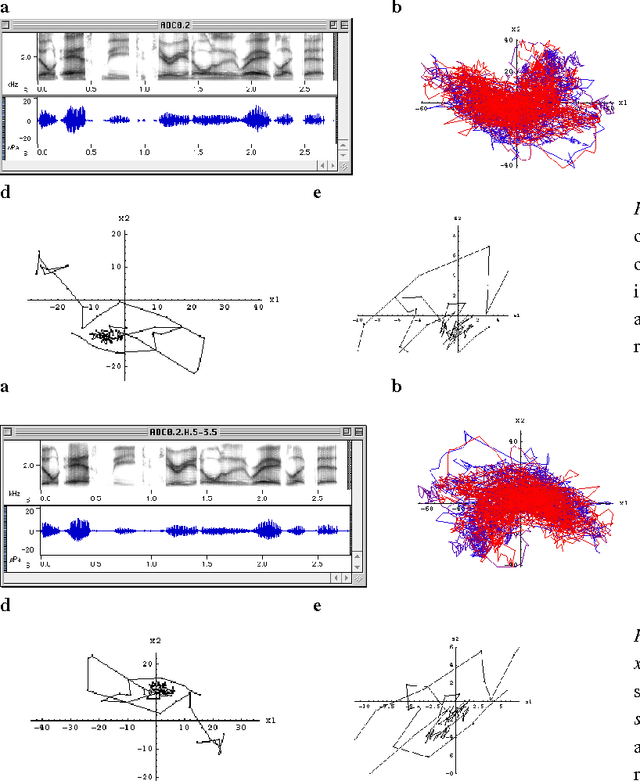 Figure 1 for Blind Normalization of Speech From Different Channels and Speakers