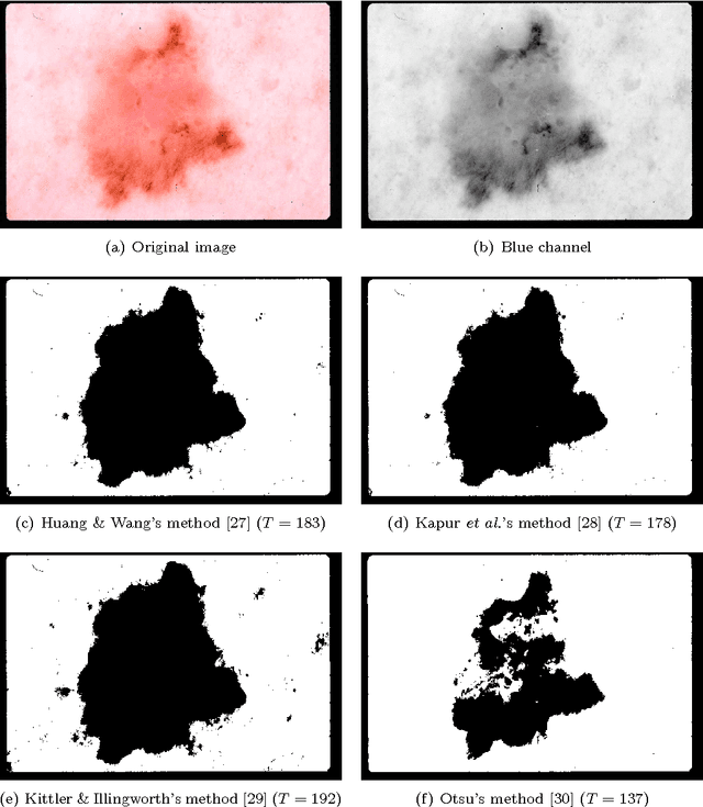 Figure 1 for Lesion Border Detection in Dermoscopy Images Using Ensembles of Thresholding Methods