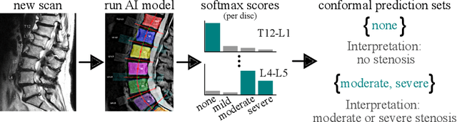 Figure 1 for Improving Trustworthiness of AI Disease Severity Rating in Medical Imaging with Ordinal Conformal Prediction Sets