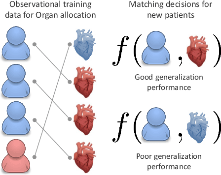 Figure 1 for Learning $\mathbf{\mathit{Matching}}$ Representations for Individualized Organ Transplantation Allocation