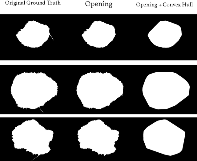 Figure 1 for Less is More: Sample Selection and Label Conditioning Improve Skin Lesion Segmentation