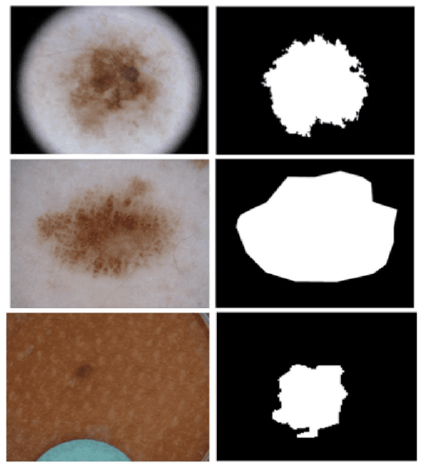 Figure 3 for Less is More: Sample Selection and Label Conditioning Improve Skin Lesion Segmentation