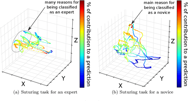 Figure 3 for Accurate and interpretable evaluation of surgical skills from kinematic data using fully convolutional neural networks