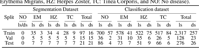 Figure 2 for EdgeMixup: Improving Fairness for Skin Disease Classification and Segmentation