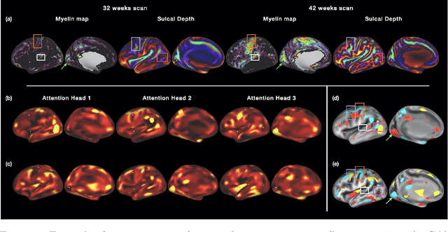 Figure 4 for Surface Vision Transformers: Attention-Based Modelling applied to Cortical Analysis