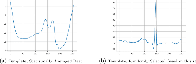 Figure 2 for Synthetic ECG Signal Generation Using Generative Neural Networks