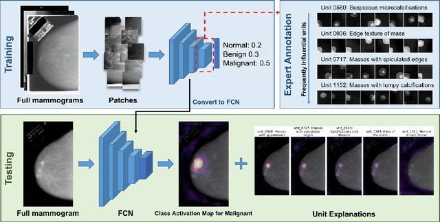 Figure 1 for DeepMiner: Discovering Interpretable Representations for Mammogram Classification and Explanation