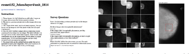 Figure 2 for DeepMiner: Discovering Interpretable Representations for Mammogram Classification and Explanation