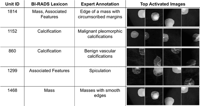 Figure 3 for DeepMiner: Discovering Interpretable Representations for Mammogram Classification and Explanation