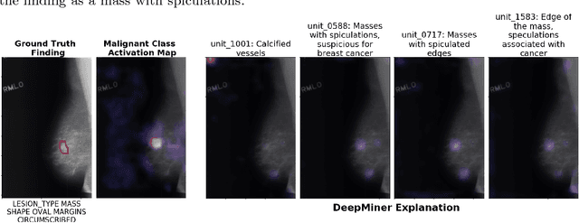 Figure 4 for DeepMiner: Discovering Interpretable Representations for Mammogram Classification and Explanation