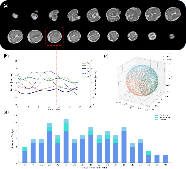 Figure 3 for AFFIRM: Affinity Fusion-based Framework for Iteratively Random Motion correction of multi-slice fetal brain MRI