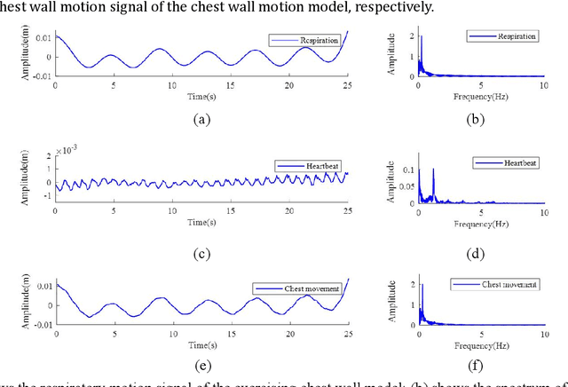 Figure 3 for Simulation and Measurement of Human Respiration and Heartbeat with Millimeter- Wave Radar