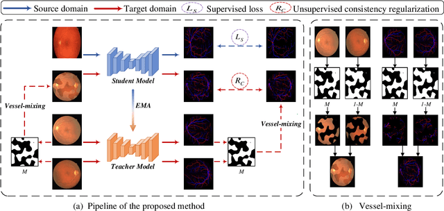 Figure 3 for Consistent Posterior Distributions under Vessel-Mixing: A Regularization for Cross-Domain Retinal Artery/Vein Classification