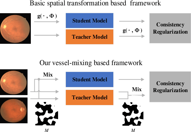 Figure 4 for Consistent Posterior Distributions under Vessel-Mixing: A Regularization for Cross-Domain Retinal Artery/Vein Classification
